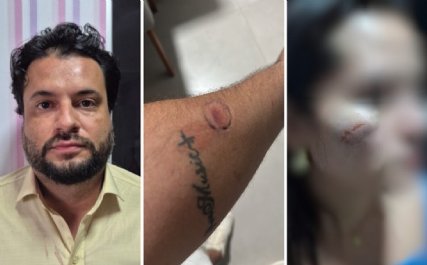 19:29 - 
							Servidor é preso pela segunda vez em menos de 10 dias por agressão contra mulher e deputado exige demissão